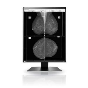 RADIFORCE MEDIC GRAYSCALE MAMMO REF - RadiForce GX560