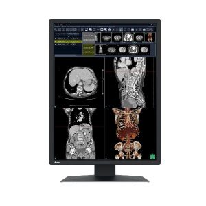 RADIFORCE MEDIC COLOR REF RADIO - RadiForce RX270