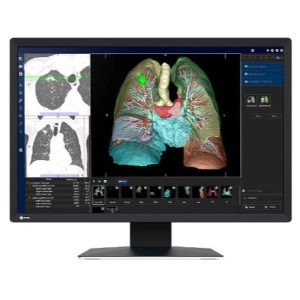 RADIFORCE MED CLINICAL REVIEW COLOR - RadiForce MX243W